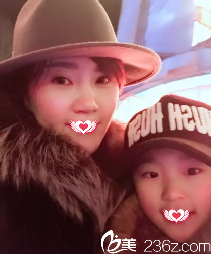 术后恢复面部皮肤紧致 术后恢复面部皮肤紧致