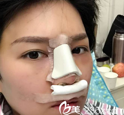 刚做完之后的我 刚做完之后的我