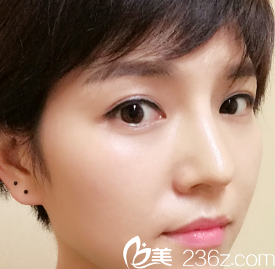 基本恢复了一个月的我 基本恢复了一个月的我