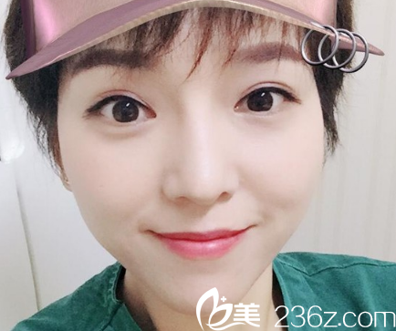 现在的鼻子真的是比较好看 现在的鼻子真的是比较好看