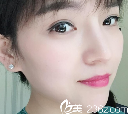 西安同安济医院整形科做假体隆鼻手术怎么样？我们通过案例来了解效果