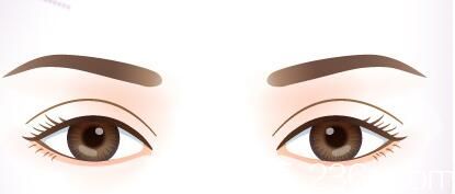 埋线双眼皮出现疙瘩