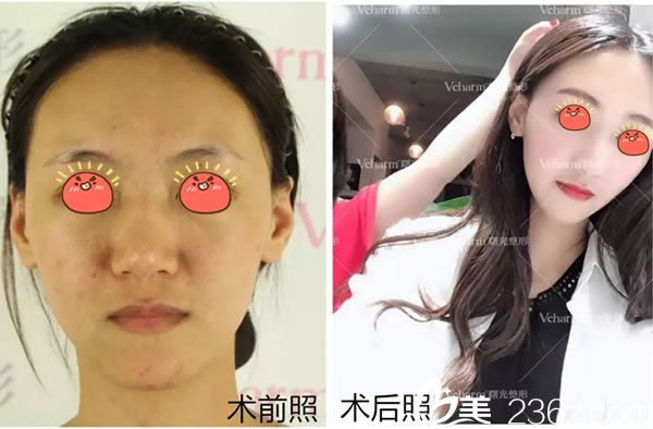 曙光明星脸真人案例效果图 曙光明星脸真人案例效果图