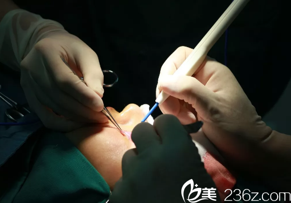 眼综合整形手术中