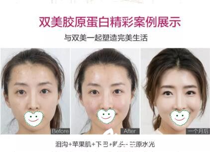 双美胶原蛋白真人案例前后效果展示