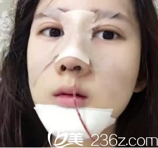 这个管子其实是有助于<span style= 这个管子其实是有助于<span style=