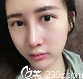 恢复了30天了 恢复了30天了