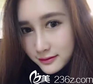 西安<!--<i data=20240703-sp></i>-->医院整形科的医生技术真的棒 西安<!--<i data=20240703-sp></i>-->医院整形科的医生技术真的棒