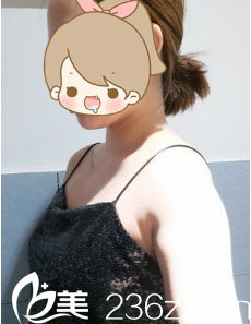 术前平胸的我 术前平胸的我