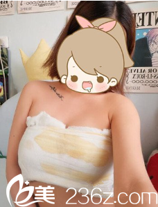 黄皓医生给我做完手术第五天 黄皓医生给我做完手术第五天