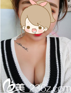 半个月乳沟已经很明显了 半个月乳沟已经很明显了