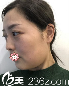 我的术前照 我的术前照