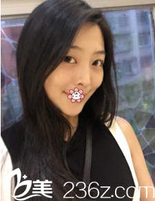 贵阳美莱做面部吸脂怎么样 贵阳美莱做面部吸脂怎么样