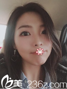 术后三个月 术后三个月