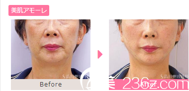 20181101_1541040601698281.png 美肌 2.png