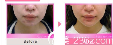 板井 美肌 板井 美肌