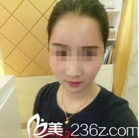 术后五天恢复效果 术后五天恢复效果