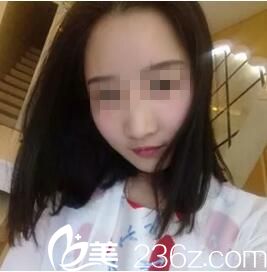 术后半个月恢复效果 术后半个月恢复效果