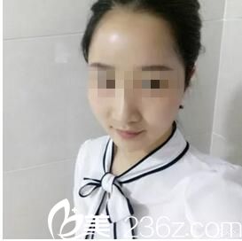 术后一个月恢复效果 术后一个月恢复效果