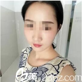 感谢曲靖吴氏嘉美用自体脂肪填充我的额头和太阳穴 不仅解决了凹陷还让我的脸恢复水嫩感