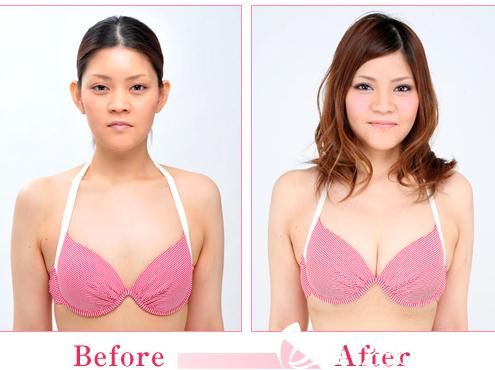 丰胸.jpg