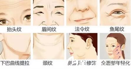 面部胶原蛋白流失出现各种皮肤衰老现象