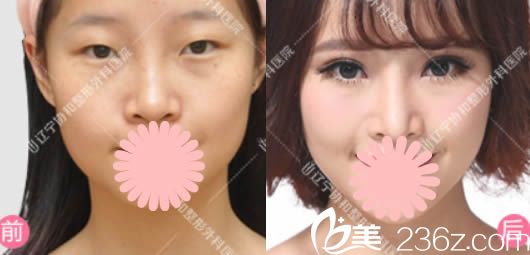 沈阳<span style= 沈阳<span style=