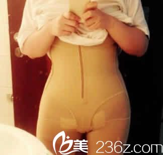 我在<!--<i data=20240703-sp></i>-->整形做360水动力吸脂后第3天照片