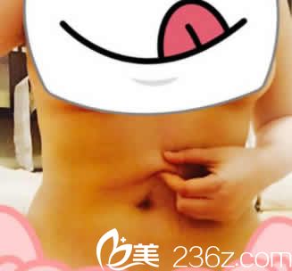 <!--<i data=20240703-sp></i>--><!--<i data=20240703-sp></i>-->给我做水动力腰腹部环吸后第8天效果