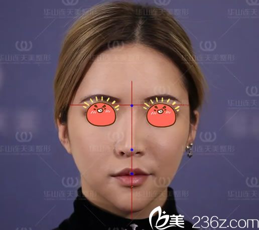 做4个鼻综合手术都失败的照片 做4个鼻综合手术都失败的照片