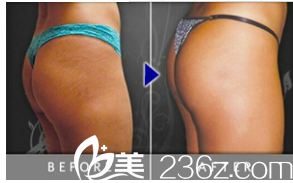 20181106_1541484321798884.png 提臀.png