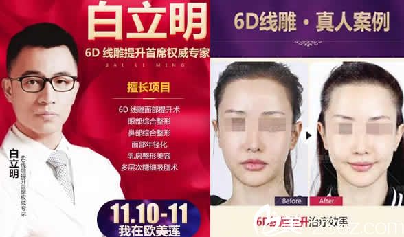 太原欧美莲整形白立明医生及面部线雕案例图