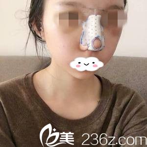 术后第二天 术后第二天