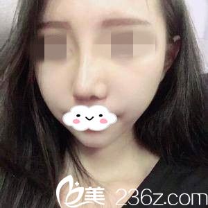 拆线后天 拆线后天