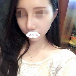 术后半个月 术后半个月