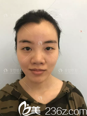 手术前的我 手术前的我