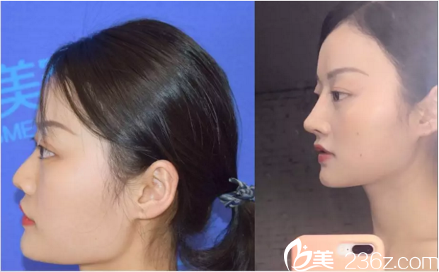 真人案例零距离展示