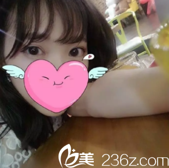 宝鸡韩美做全切双眼皮手术挺厉害的，通过案例来看技术确实不错