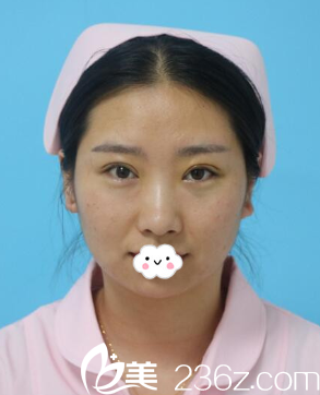 到咸阳公立医院<i data-id='0fc1f97a-7e81-4446-b20d-c7f56a37e144' style='display:none;'></i>整形科做双眼皮效果 到咸阳公立医院<i data-id='0fc1f97a-7e81-4446-b20d-c7f56a37e144' style='display:none;'></i>整形科做双眼皮效果