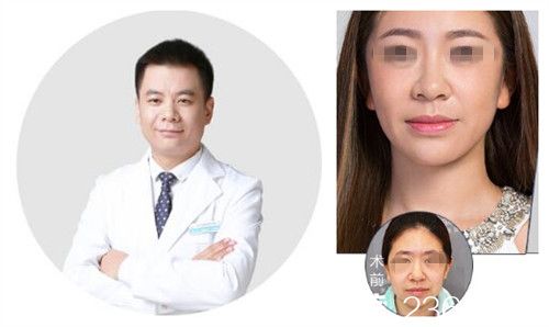 北京米扬丽格夏正义隆鼻案例