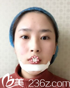 手术后第二天 手术后第二天