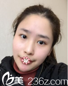 刘德东院长给我做完手术后第8天 刘德东院长给我做完手术后第8天