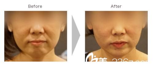 <span style= <span style=