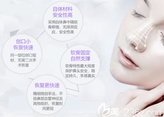 杭州美联致美整形公布2018年11月全新价格表 双眼皮999元起,隆鼻1680元起