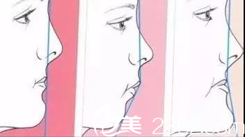 面部轮廓示意图 面部轮廓示意图