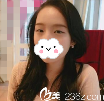 手术前的我 手术前的我