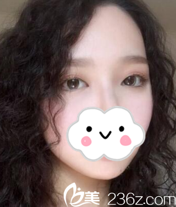 术后一周的效果 术后一周的效果