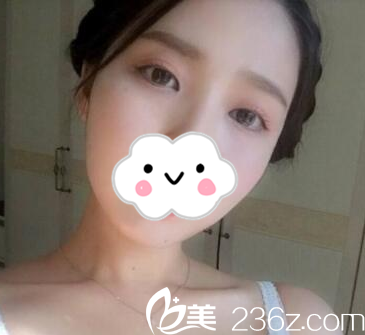 术后半个月 术后半个月