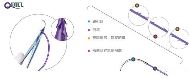 蛋白线羽毛提拉 蛋白线羽毛提拉