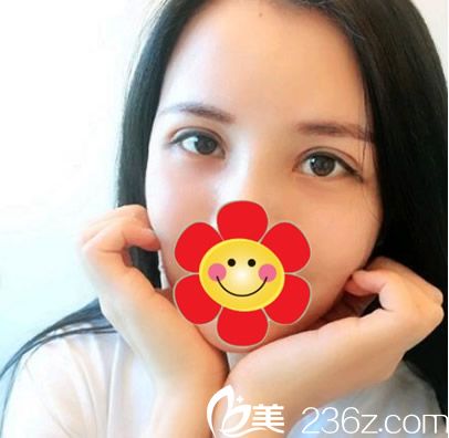 超声波去眼袋半个月效果 超声波去眼袋半个月效果